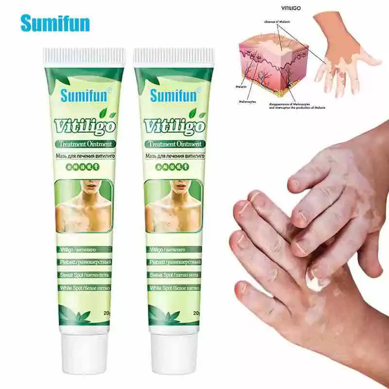 1 Orzinal Vitiligo Treatment Cream